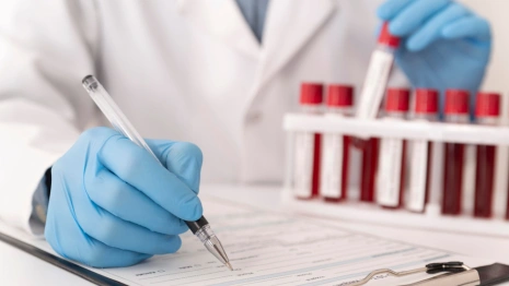 Во Владимирской области выявили 250 ВИЧ-инфицированных