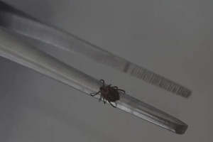 Во Владимирской области с людей сняли 2 зараженных инфекциями клещей