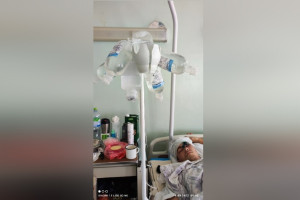 В Коврове после жуткого ДТП со столбом открыли сбор денег на операцию пострадавшему юноше