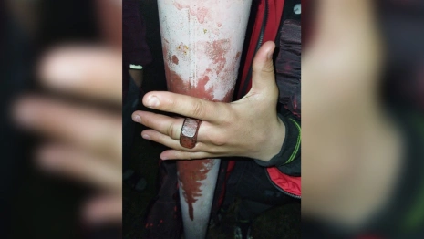 Во Владимире 11-летний мальчик оказался прикованным к столбу