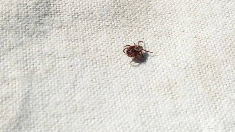 Во Владимирской области с людей сняли пять зараженных болезнью Лайма клещей