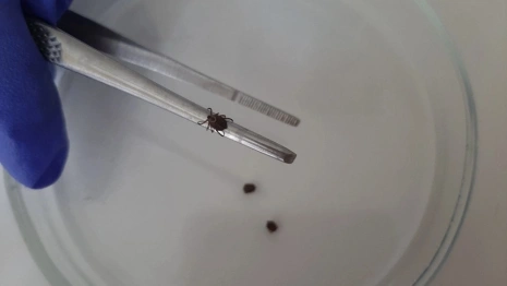 Во Владимирской области с людей сняли 12 зараженных вирусами клещей