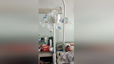 В Коврове после жуткого ДТП со столбом открыли сбор денег на операцию пострадавшему юноше