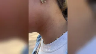 В Сети появились слухи об избиении детей группой подростков в Карабаново