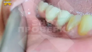 Изуродованная стоматологией женщина отсудила 3 млн рублей во Владимире